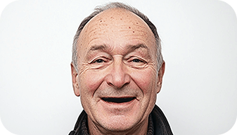 Пациент Алексей